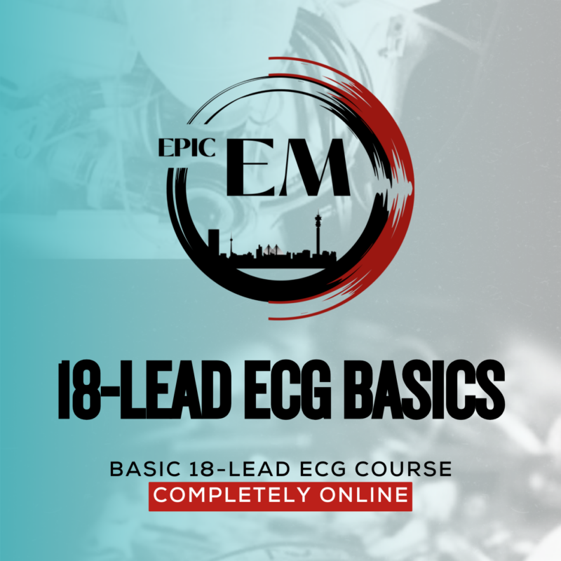 18 Lead ECG Basics ONLINE